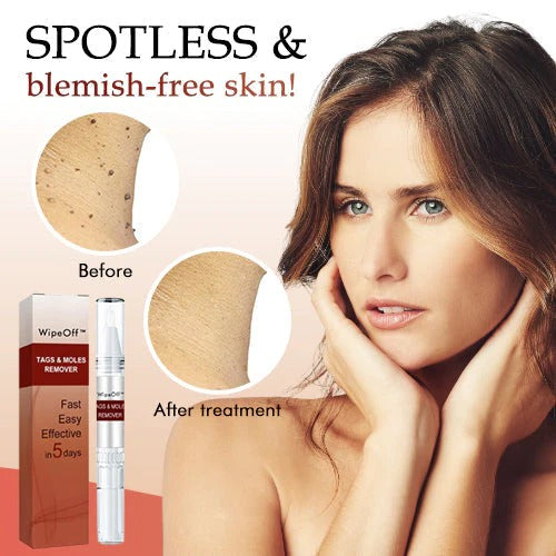 Wipe off Tags & Moles Remover - Effortlessly Remove Skin Tags and Moles